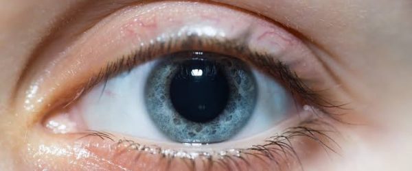 dilated eye